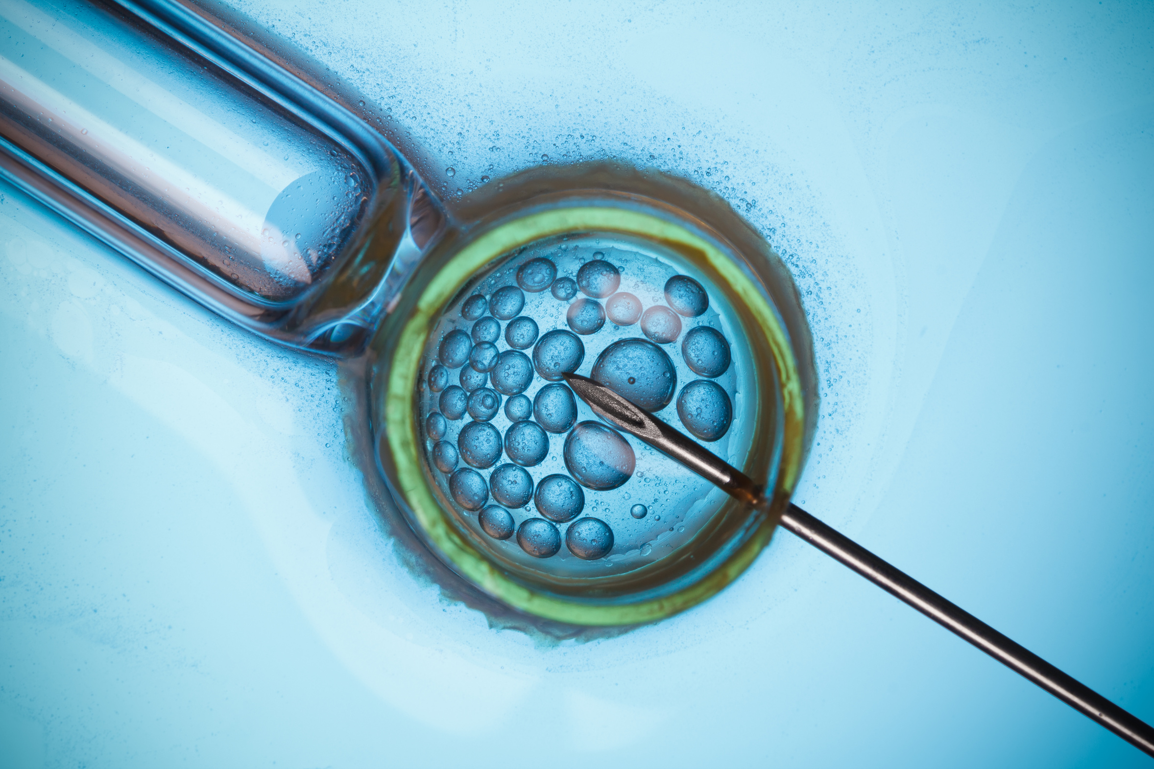 In vitro fertilisation, IVF macro concept