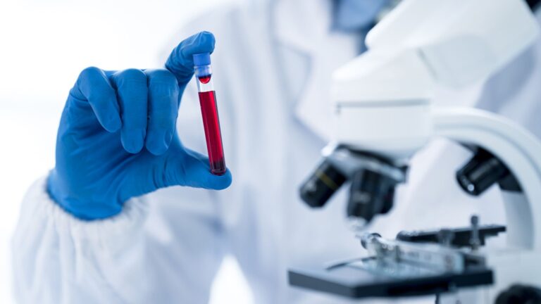 Fertility-blood-test-